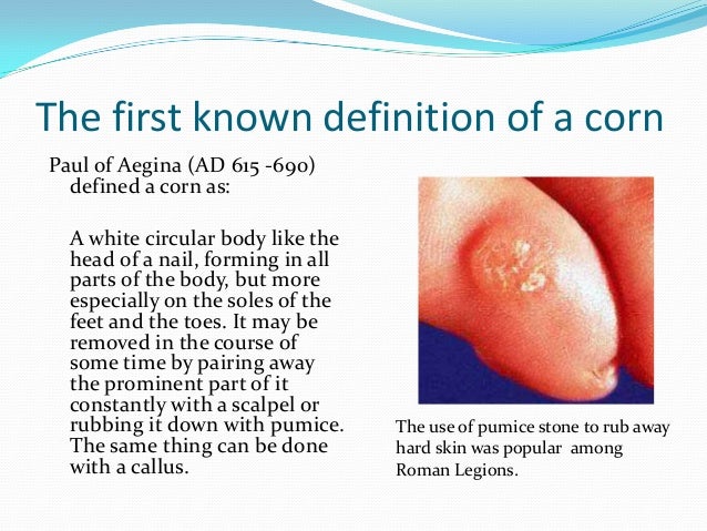 foot care definition foot care definition
